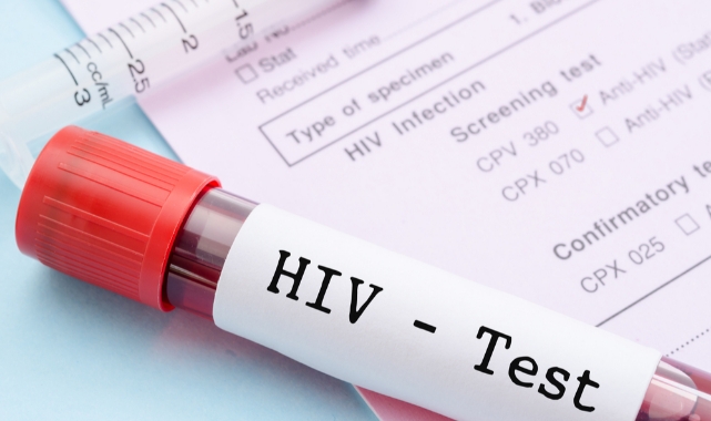 Adana İl Sağlık Müdürlüğü uyardı AIDS’e dikkat!