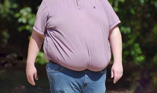 Çağın Vebası Obezite
