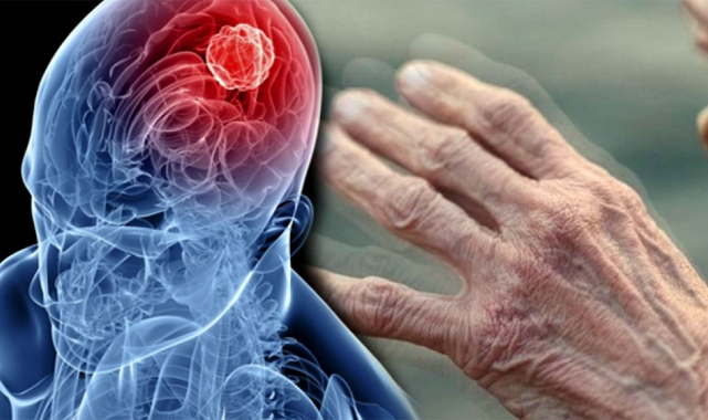 Hava Kirliliği Ve Böcek İlaçları Parkinson Riskini Artırıyor