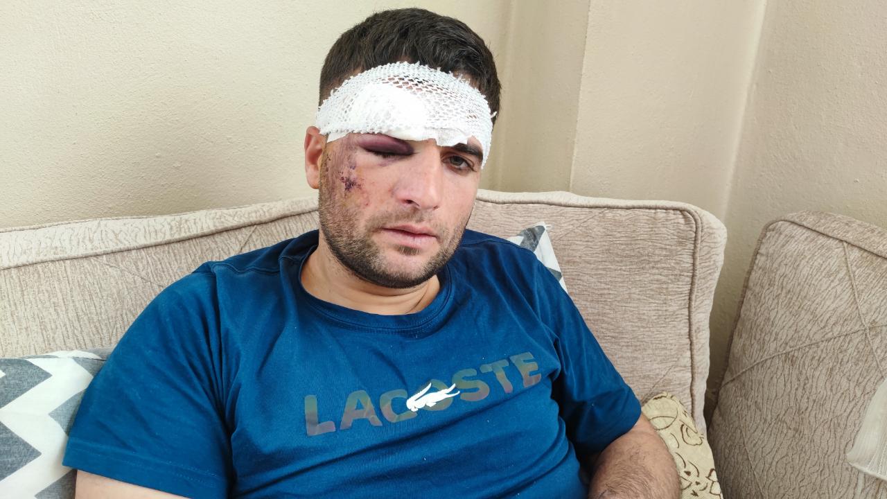 Yaralı Sürücüden ''Bırakıp Kaçtılar'' İddiası