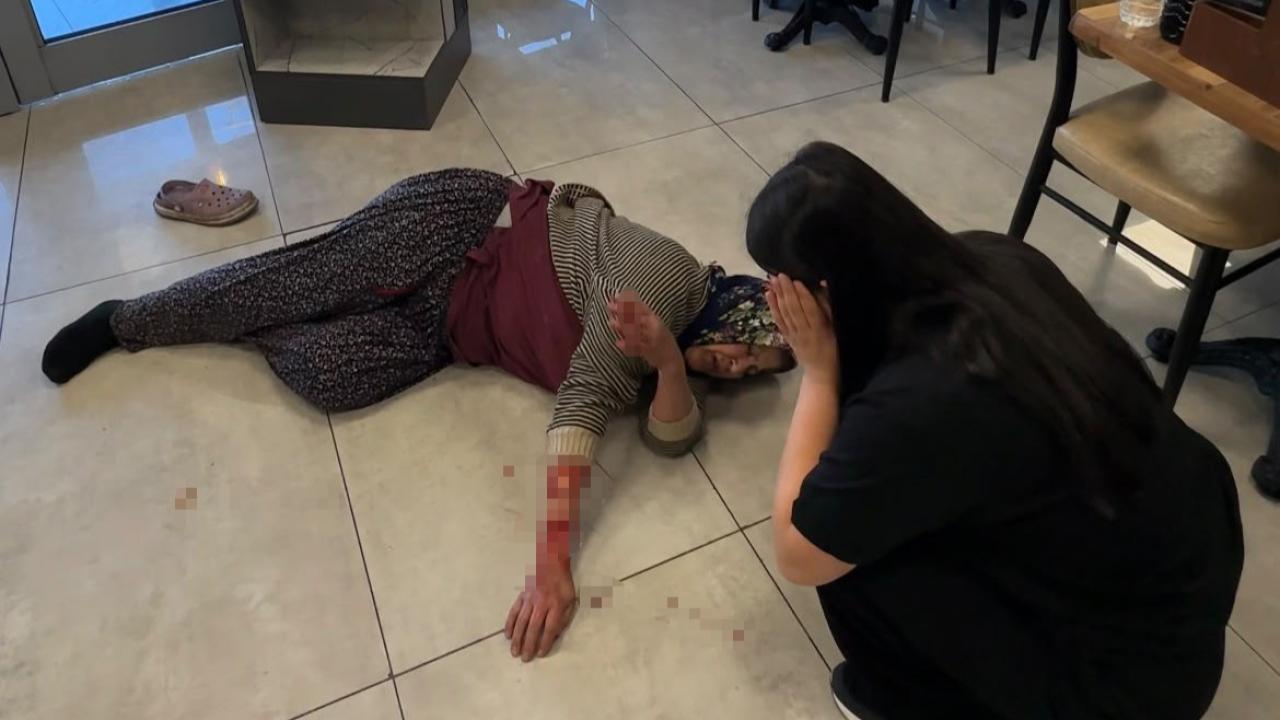 Köpek Dehşeti! Tekmelere Aldrımadı, Kadının Kolunu Kopardı