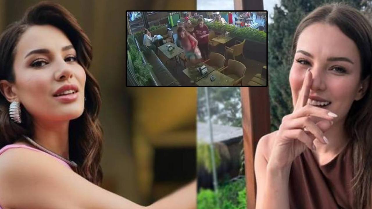Maymun Isırığı Şüphesi Vardı:Ünlü Oyuncunun Ölüm Nedeni Belli Oldu